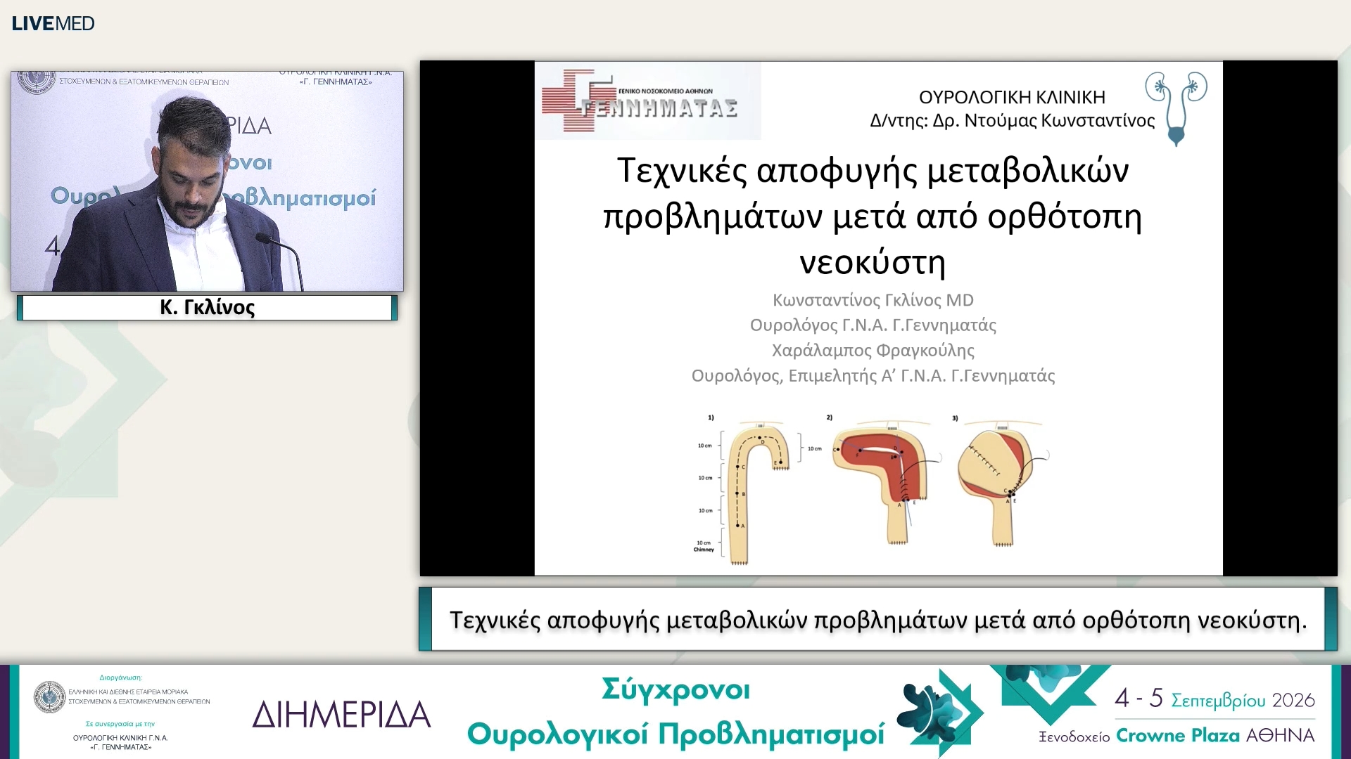 28 Κ. Γκλίνος - Τεχνικές αποφυγής μεταβολικών προβλημάτων μετά από ορθότοπη νεοκύστη. 