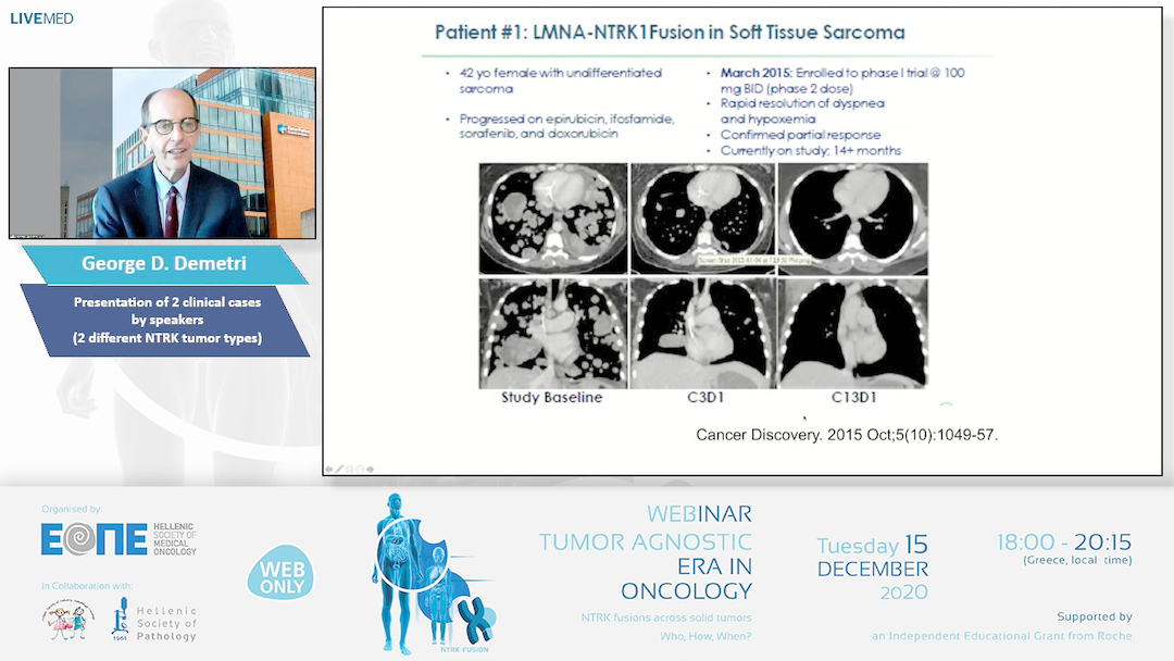 05 George D. Demetri - Presentation of 2 clinical cases by speakers (2 different NTRK tumor types) 