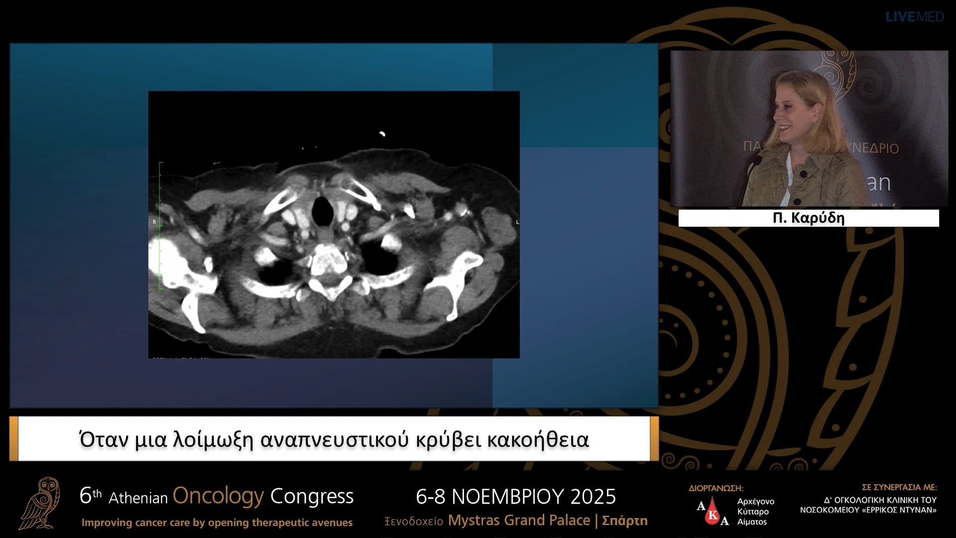 06 Π. Καρύδη - Όταν μια λοίμωξη αναπνευστικού κρύβει κακοήθεια.