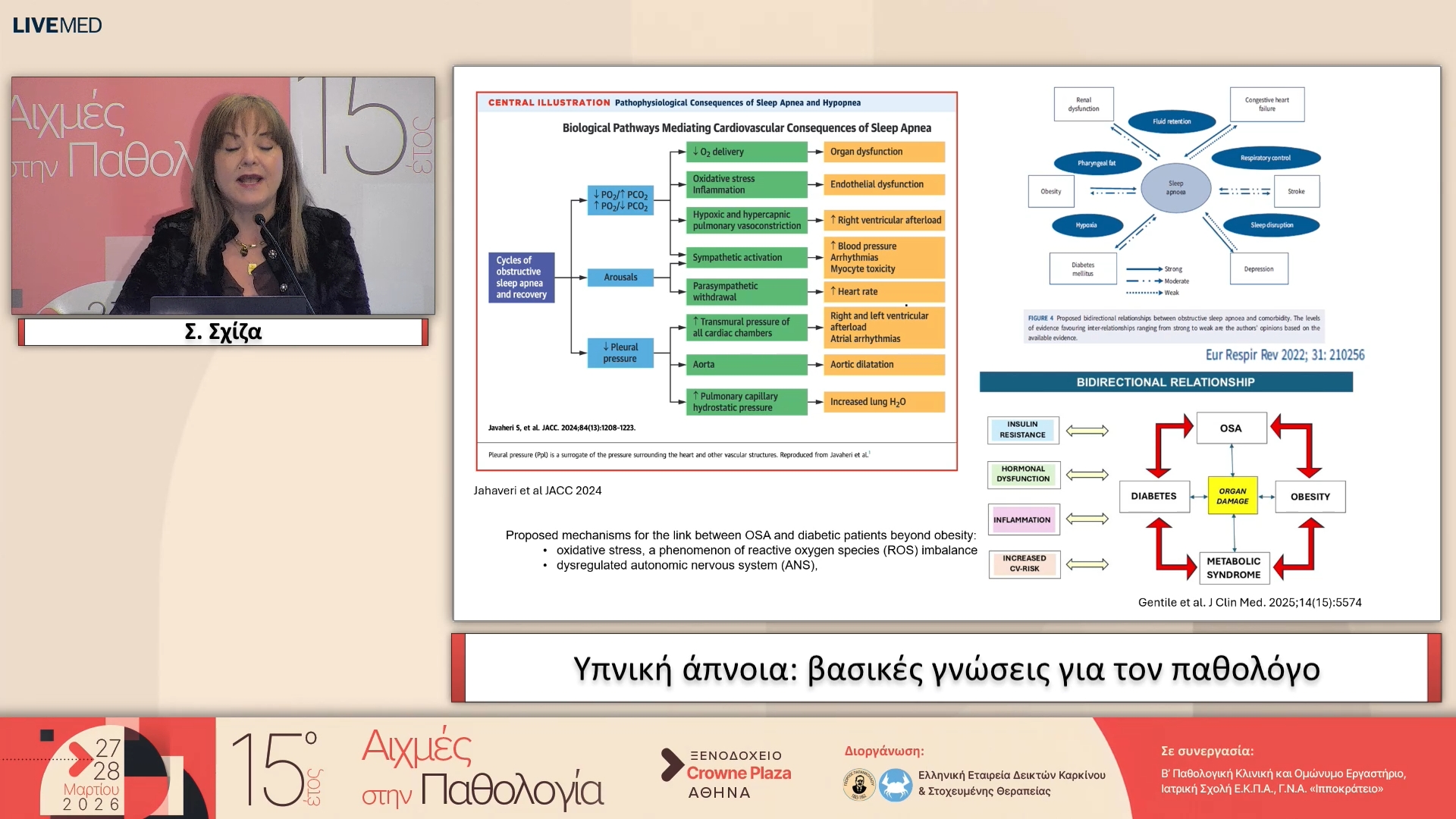 58 Σ. Σχίζα - Υπνική άπνοια: βασικές γνώσεις για τον παθολόγο