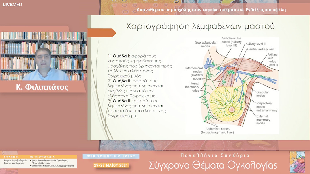30 Κ. Φιλιππάτος - Ακτινοθεραπεία μασχάλης στον καρκίνο του μαστού. Ενδείξεις και οφέλη 