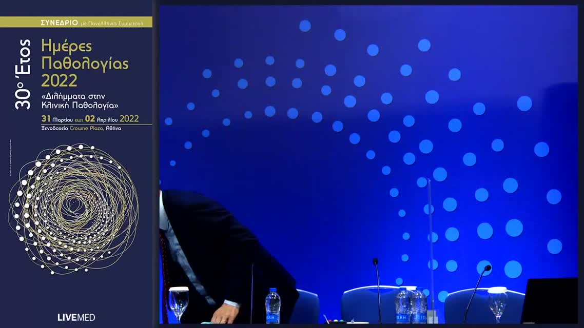 60 Σ. Βασιλοπούλου - Διερεύνηση και αντιμετώπιση ασυμπτωματικού ασθενούς με μικροϊσχαιμικές αλλοιώσεις 