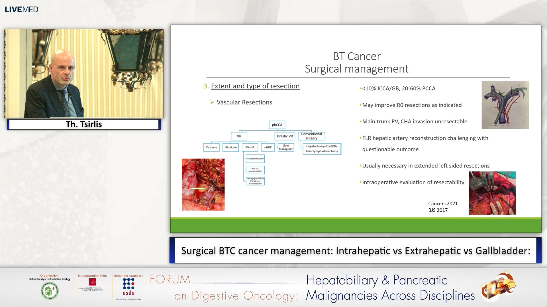 20 Th. Tsirlis - Surgical BTC cancer management: Intrahepatic vs Extrahepatic vs Gallbladder