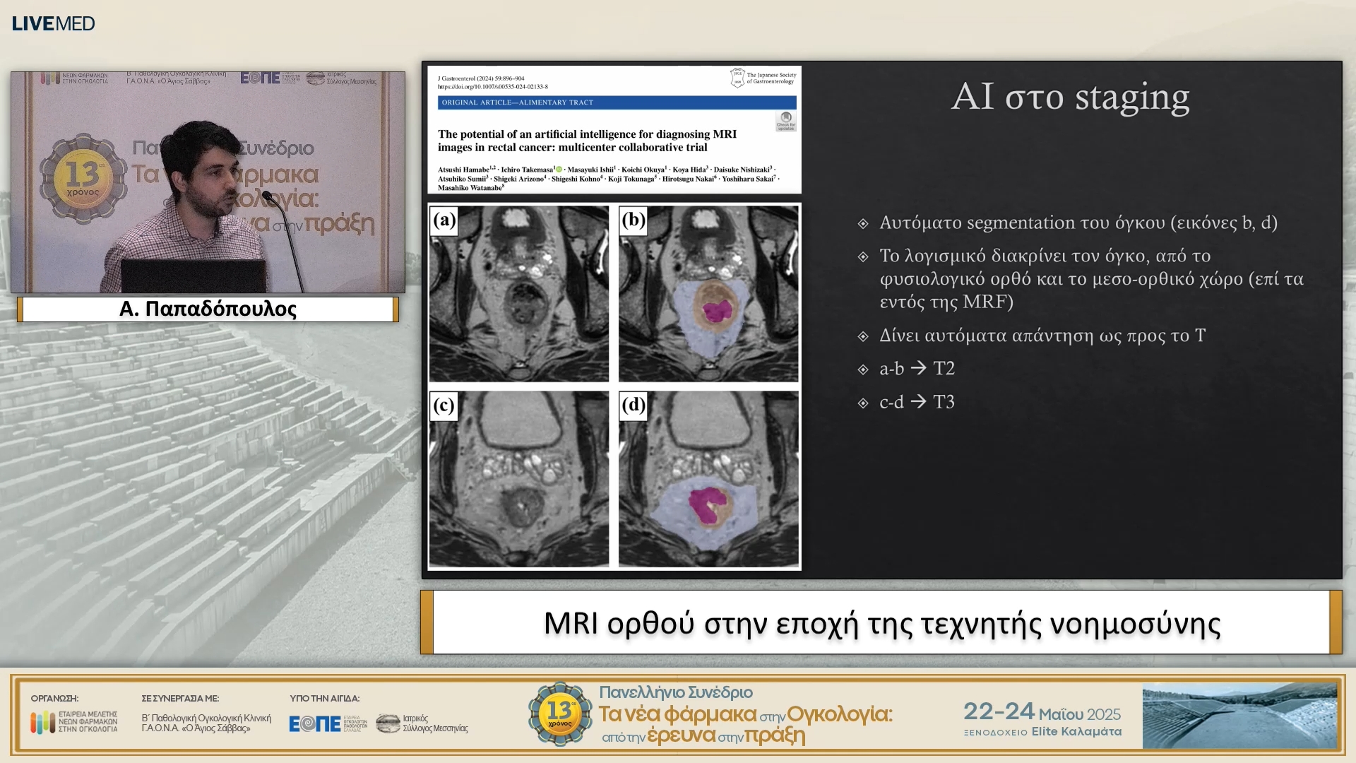 19 Α. Παπαδόπουλος - MRI ορθού στην εποχή της τεχνητής νοημοσύνης.