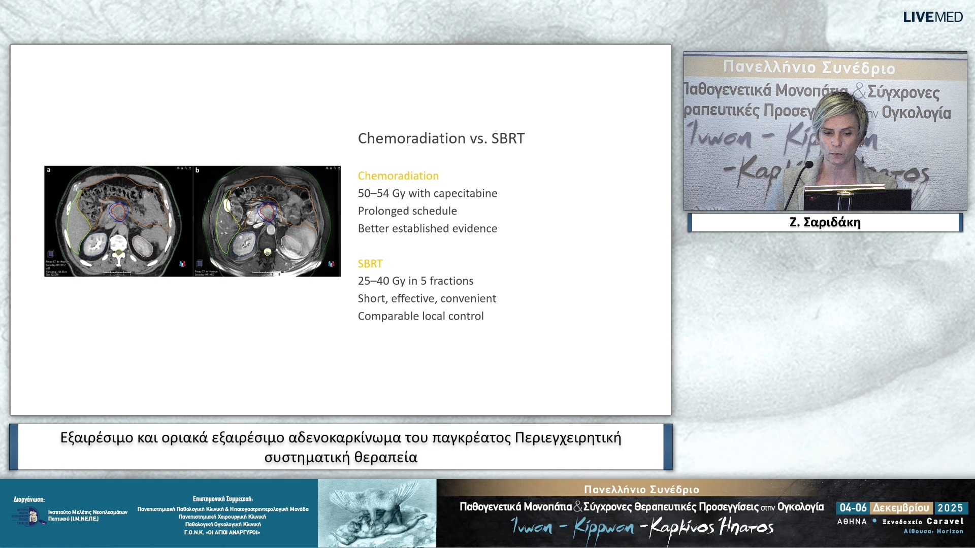 17 Ζ. ΣαριδάκηΕξαιρέσιμο και οριακά εξαιρέσιμο αδενοκαρκίνωμα του παγκρέατος • Περιεγχειρητική συστηματική θεραπεία