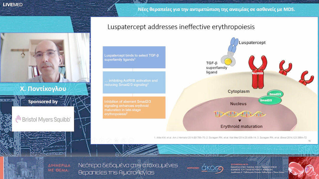 21 Χ. Ποντίκογλου - Νέες θεραπείες για την αντιμετώπιση της αναιμίας σε ασθενείς με MDS.