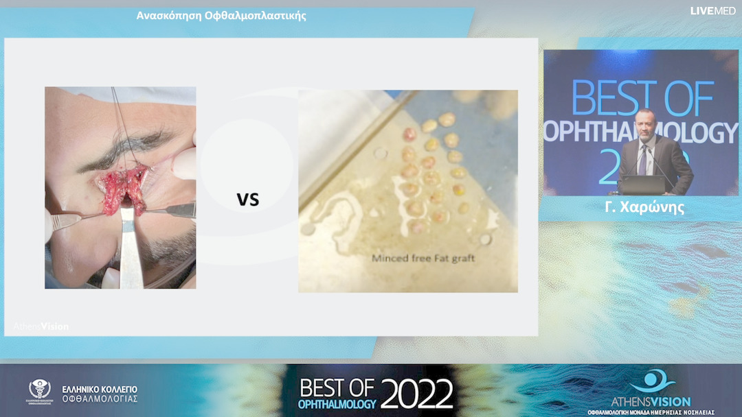 14 Γ. Χαρώνης - Ανασκόπηση Οφθαλμοπλαστικής