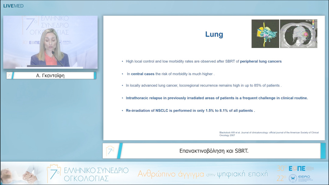 14 Α. Γκανταΐφη - Επανακτινοβόληση και SBRT. 