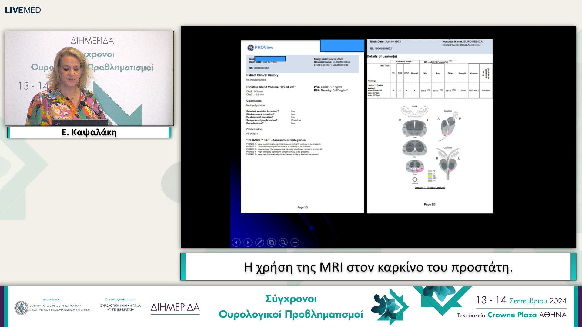 25 Ε. Καψαλάκη - Η χρήση της ΜRI στον καρκίνο του προστάτη. 