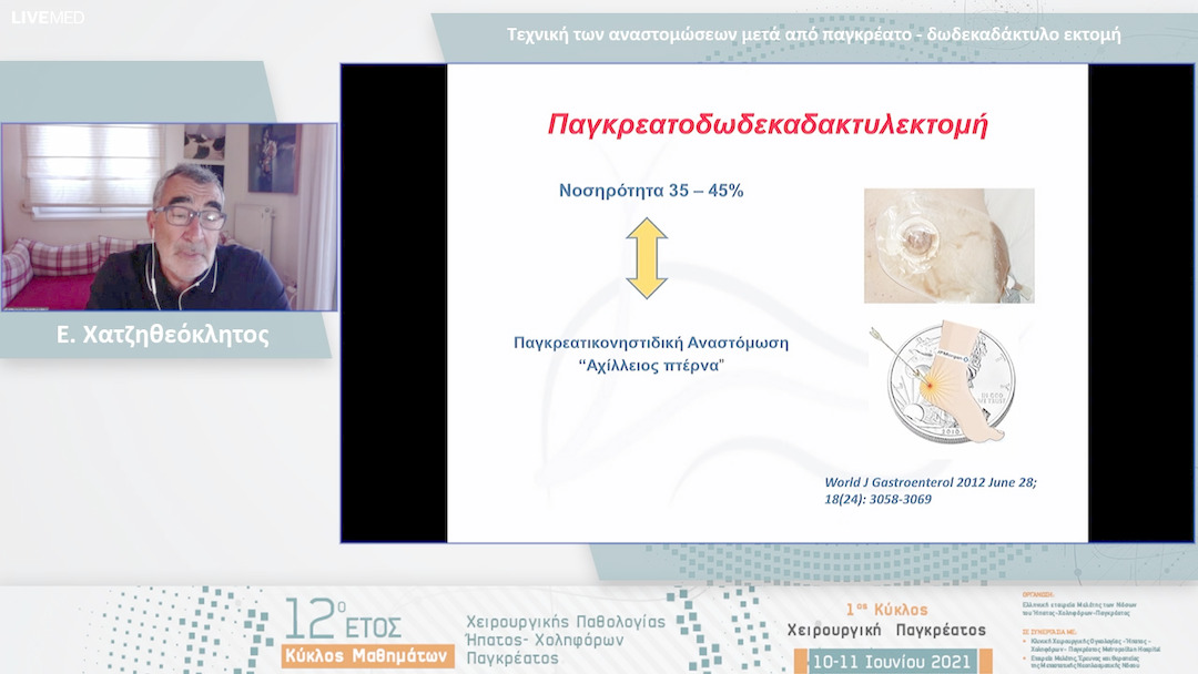 15 Ε. Χατζηθεόκλητος - Τεχνική των αναστομώσεων μετά από παγκρέατο - δωδεκαδάκτυλο εκτομή