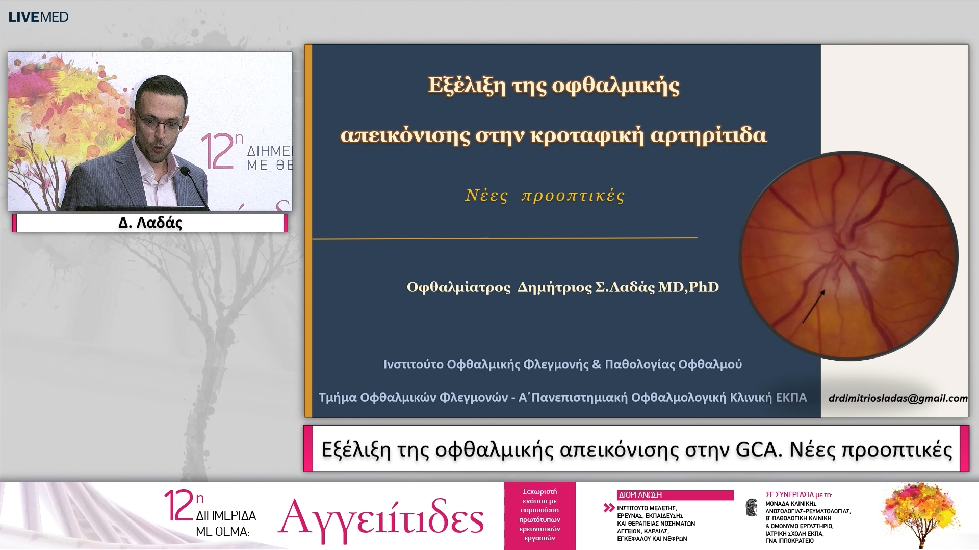 43 Δ. Λαδάς - Εξέλιξη της οφθαλμικής απεικόνισης στην GCA. Νέες προοπτικές