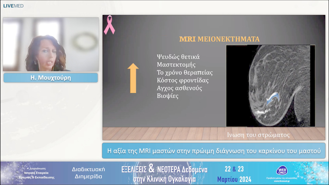 22 Η. Μουχτούρη - Η αξία της MRI μαστών στην πρώιμη διάγνωση του καρκίνου του μαστού 