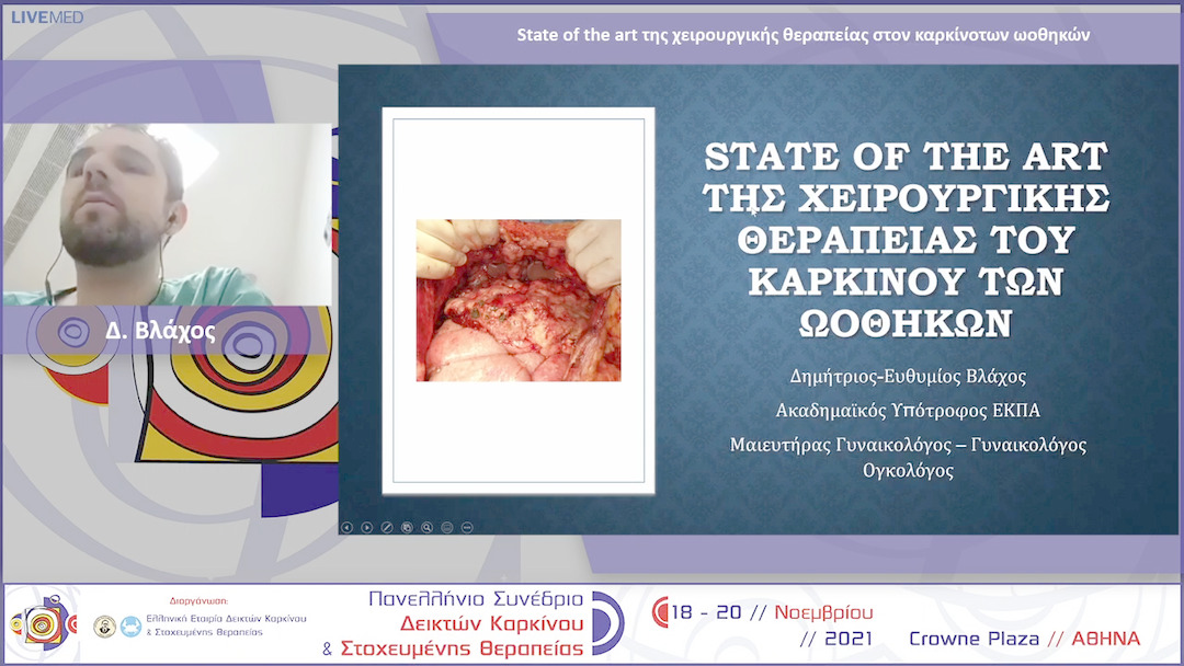 35 Δ. Βλάχος - State of the art της χειρουργικής θεραπείας στον καρκίνο των ωοθηκών 
