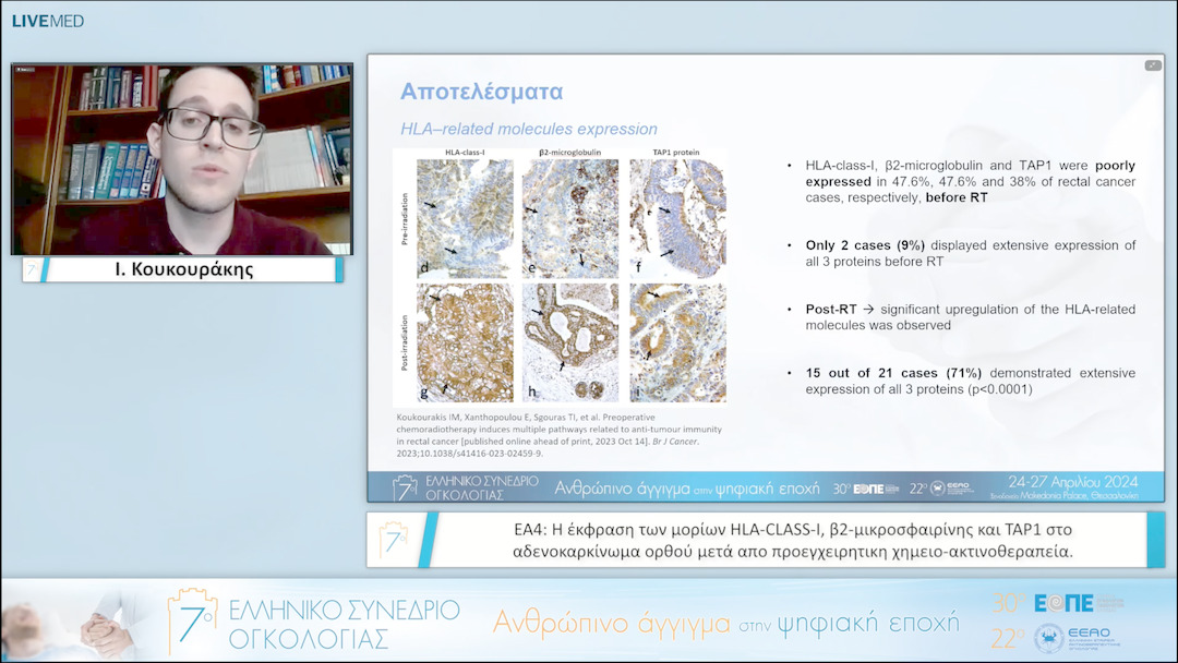 034 Ι. Κουκουράκης - ΕΑ4: Η έκφραση των μορίων HLACLASSI, β2μικροσφαιρίνης και TAP1 στο αδενοκαρκίνωμα ορθού μετά απο προεγχειρητικη χημειοακτινοθεραπεία. 