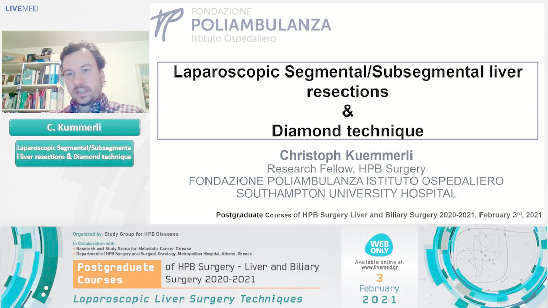 04 C. Kummerli - Laparoscopic Segmental/Subsegmental liver resections & Diamond technique