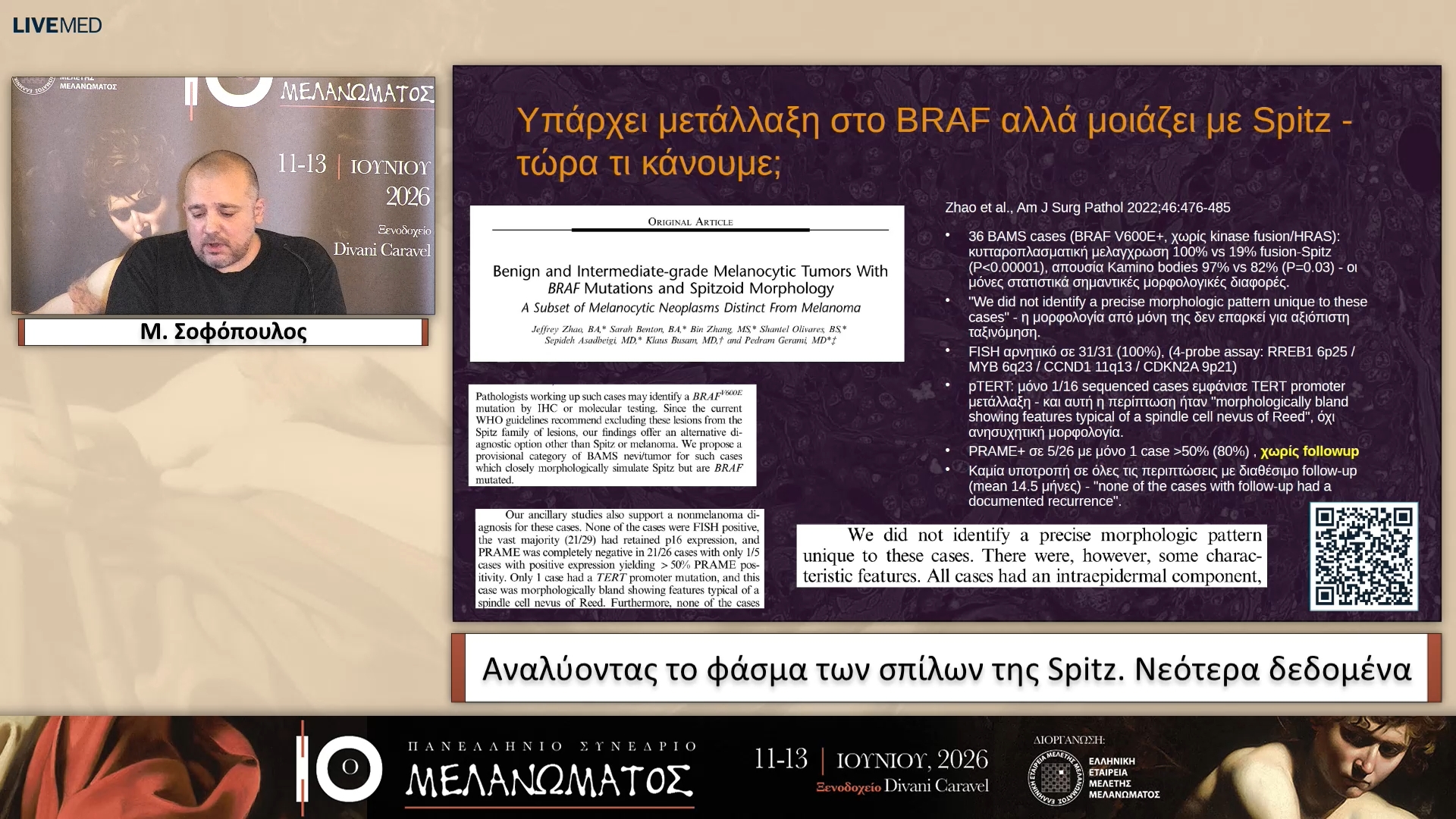 30 Μ. Σοφόπουλος - Αναλύοντας το φάσμα των σπίλων της Spitz. Νεότερα δεδομένα