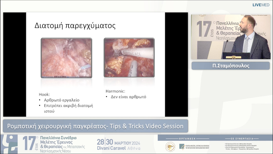 21 Γ. Σωτηρόπουλος - Ρομποτική χειρουργική παγκρέατος- Tips & Tricks Video Session 