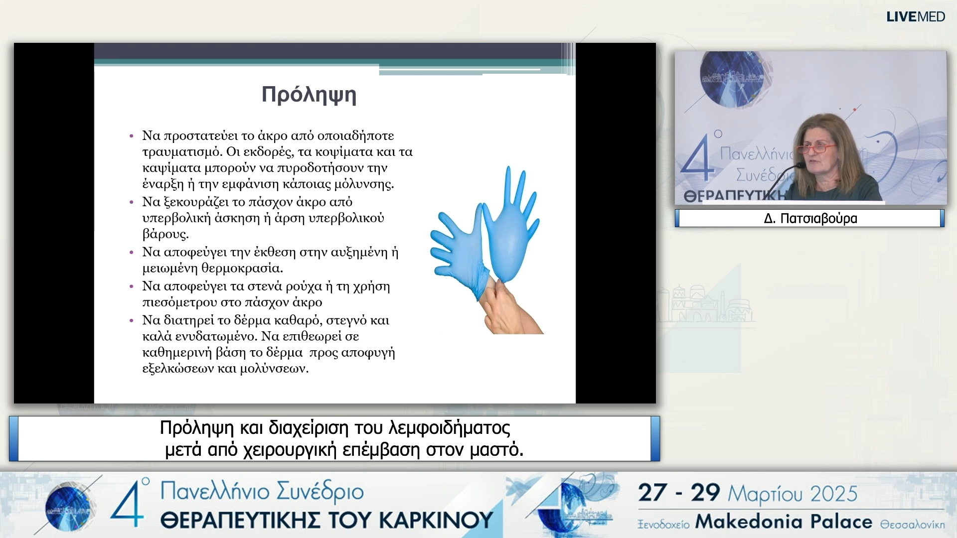 13 Δ. Πατσιαβούρα - Πρόληψη και διαχείριση του λεμφοιδήματος μετά από χειρουργική επέμβαση στον μαστό