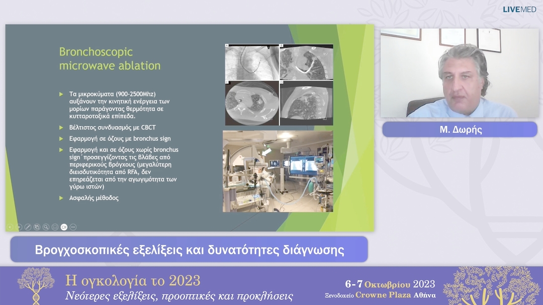 33  Μ. Δωρής - Βρογχοσκοπικές εξελίξεις και δυνατότητες διάγνωσης