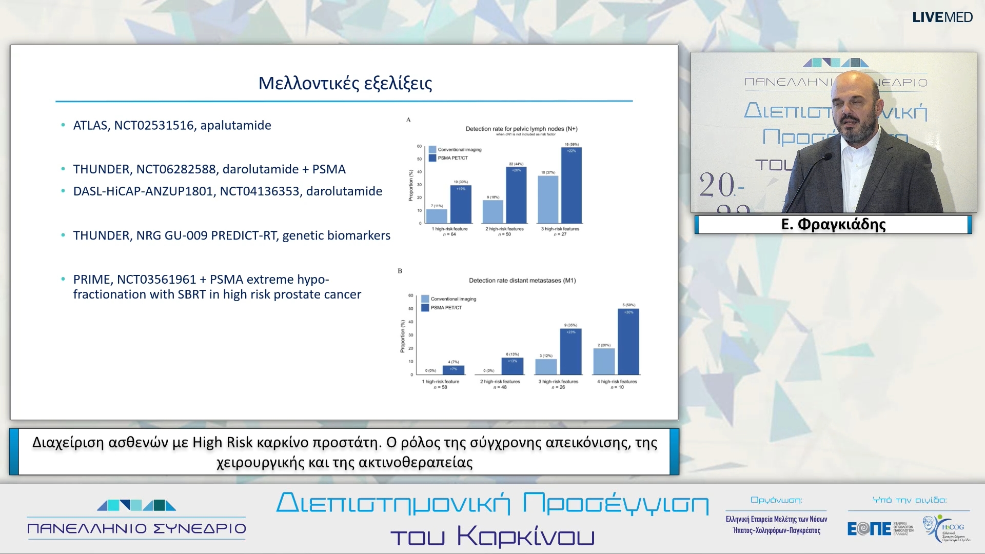 58 Ε. Φραγκιάδης - Διαχείριση ασθενών με High Risk καρκίνο προστάτη. Ο ρόλος της σύγχρονης απεικόνισης, της χειρουργικής και της ακτινοθεραπείας.
