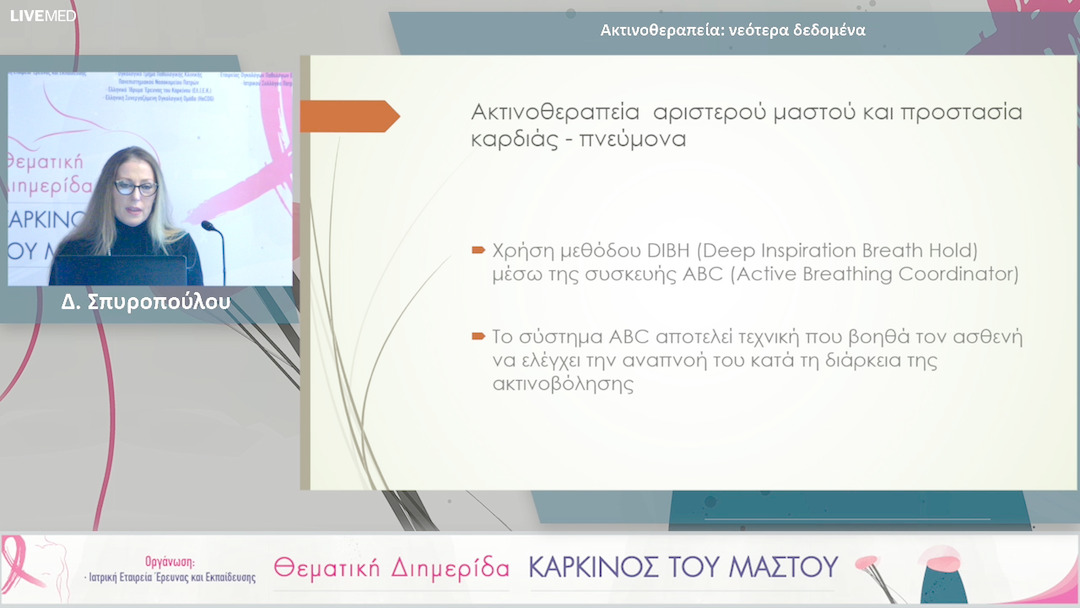 34 Δ. Σπυροπούλου - Ακτινοθεραπεία: νεότερα δεδομένα 