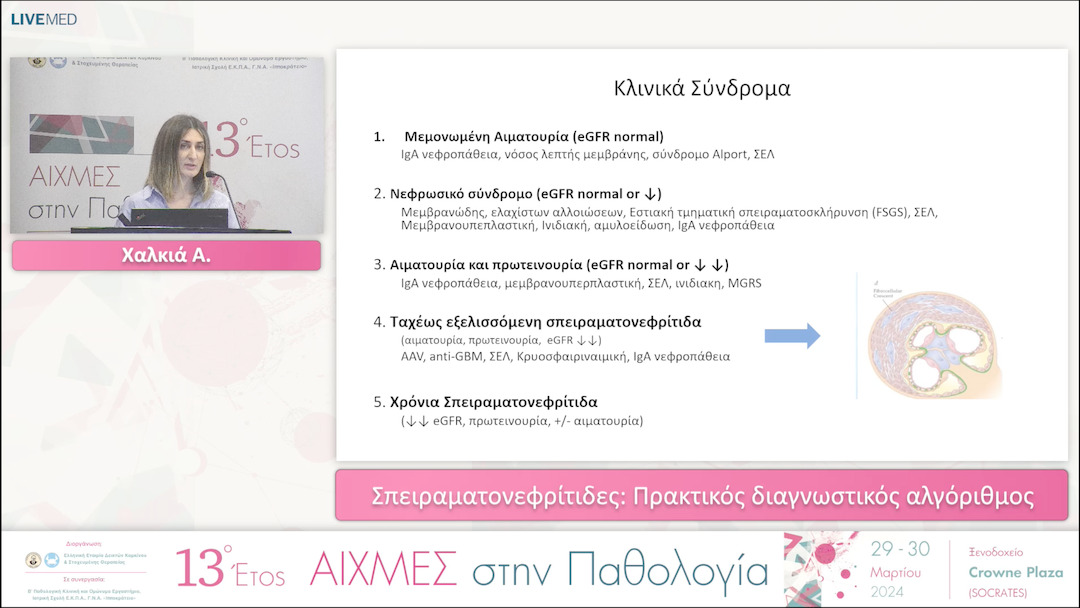 19 Χαλκιά Α. - Σπειραματονεφρίτιδες: Πρακτικός διαγνωστικός αλγόριθμος. 