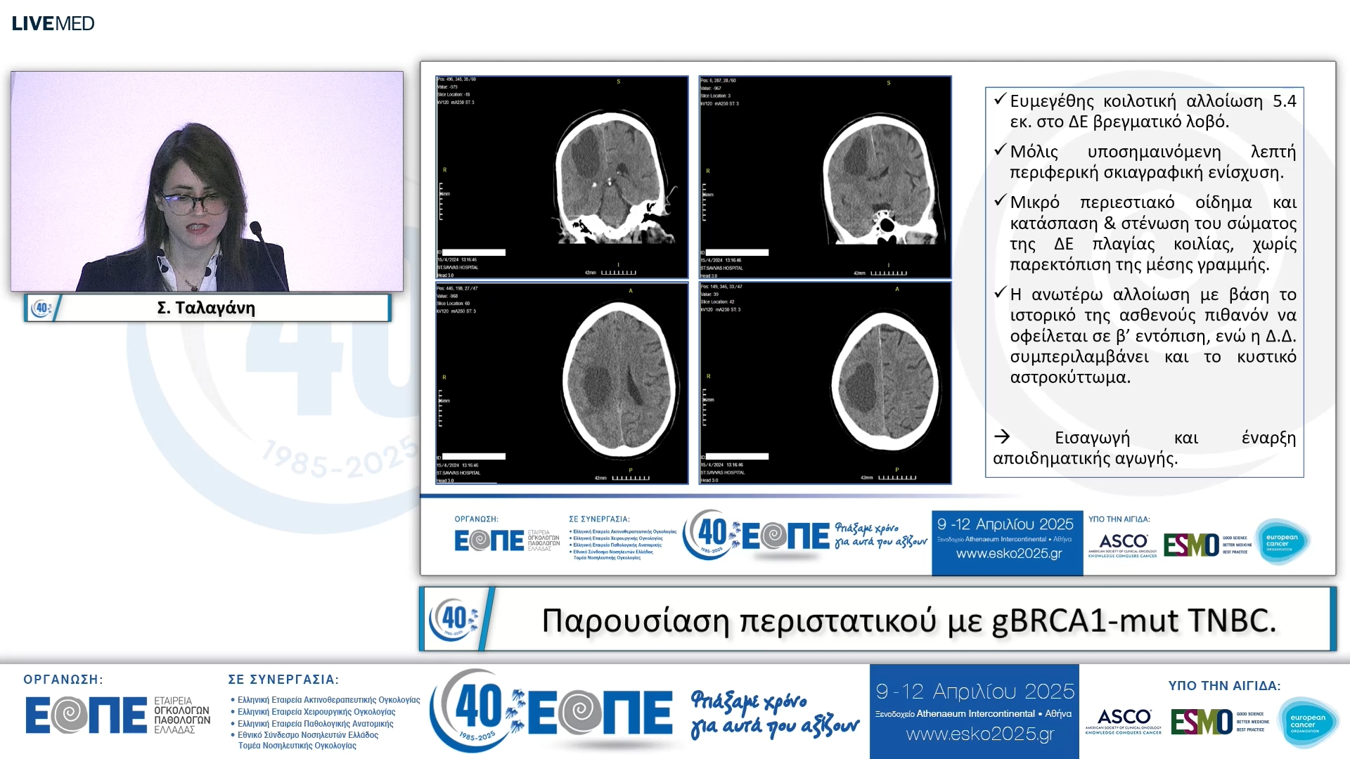 068 Σ. Ταλαγάνη - Παρουσίαση περιστατικού με gBRCA1-mut TNBC