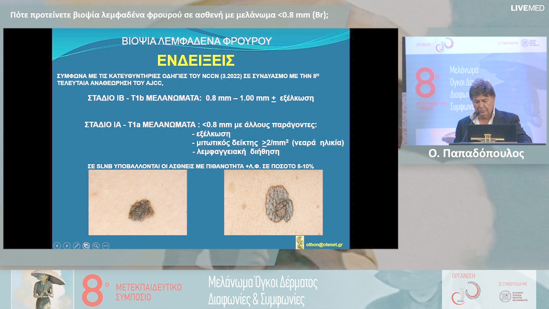 21 Ο. Παπαδόπουλος - Πότε προτείνετε βιοψία λεμφαδένα φρουρού σε ασθενή με μελάνωμα 0.8 mm (Br); 