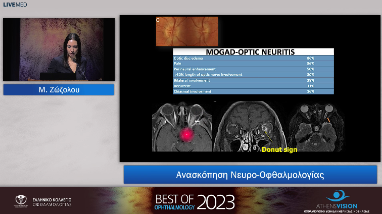 14 Μ. Ζώζολου - Aνασκόπηση Νευρο-Οφθαλμολογίας