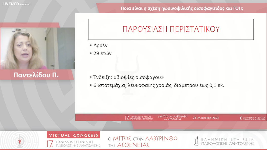 39 Παντελίδου Π. - Ποια είναι η σχέση ηωσινοφιλικής οισοφαγίτιδος και ΓΟΠ; 