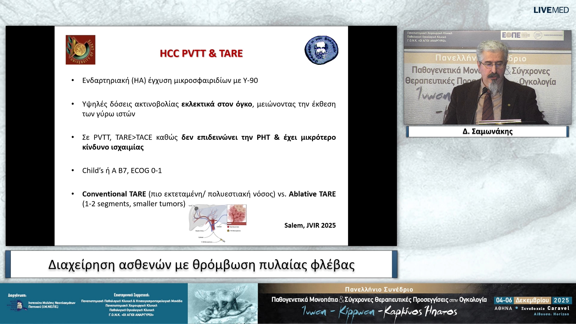 62 Δ. Σαμωνάκης - Διαχείριση ασθενών με θρόμβωση πυλαίας φλέβας