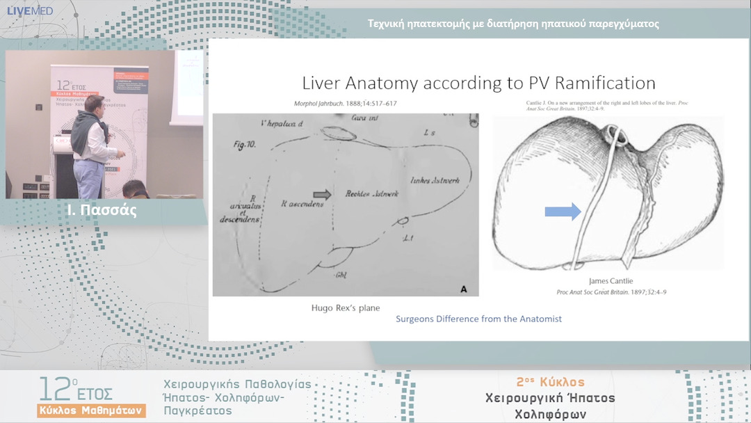 23  Ι. Πασσάς - Τεχνική ηπατεκτομής με διατήρηση ηπατικού παρεγχύματος