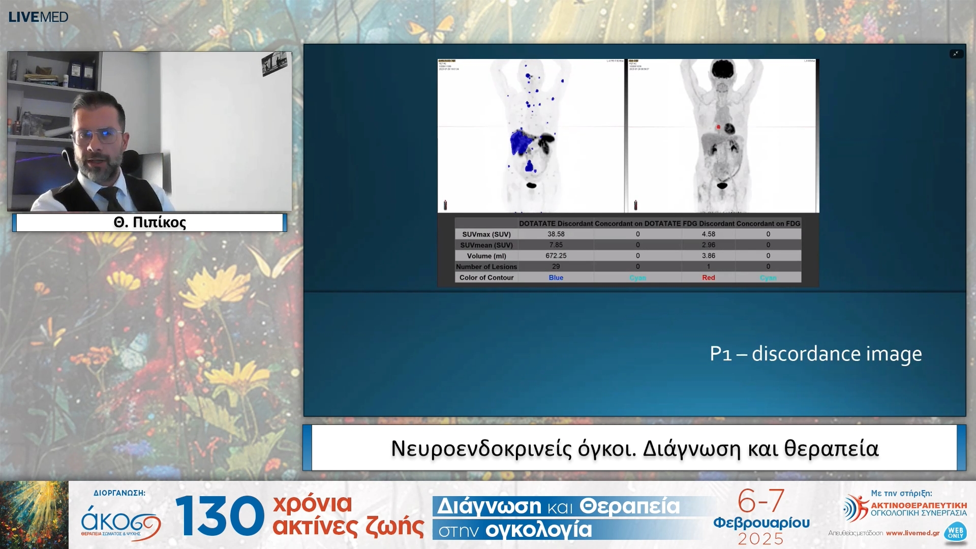 16  Θ. Πιπίκος - Νευροενδοκρινείς όγκοι. Διάγνωση και θεραπεία