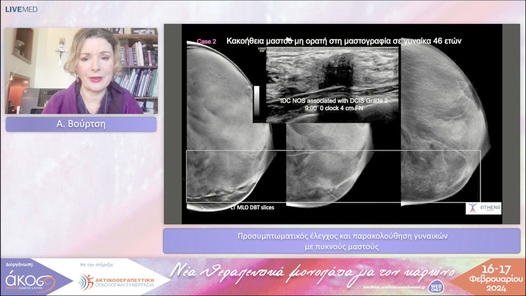 24 Α. Βούρτση - Προσυμπτωματικός έλεγχος και παρακολούθηση γυναικών με πυκνούς μαστούς 