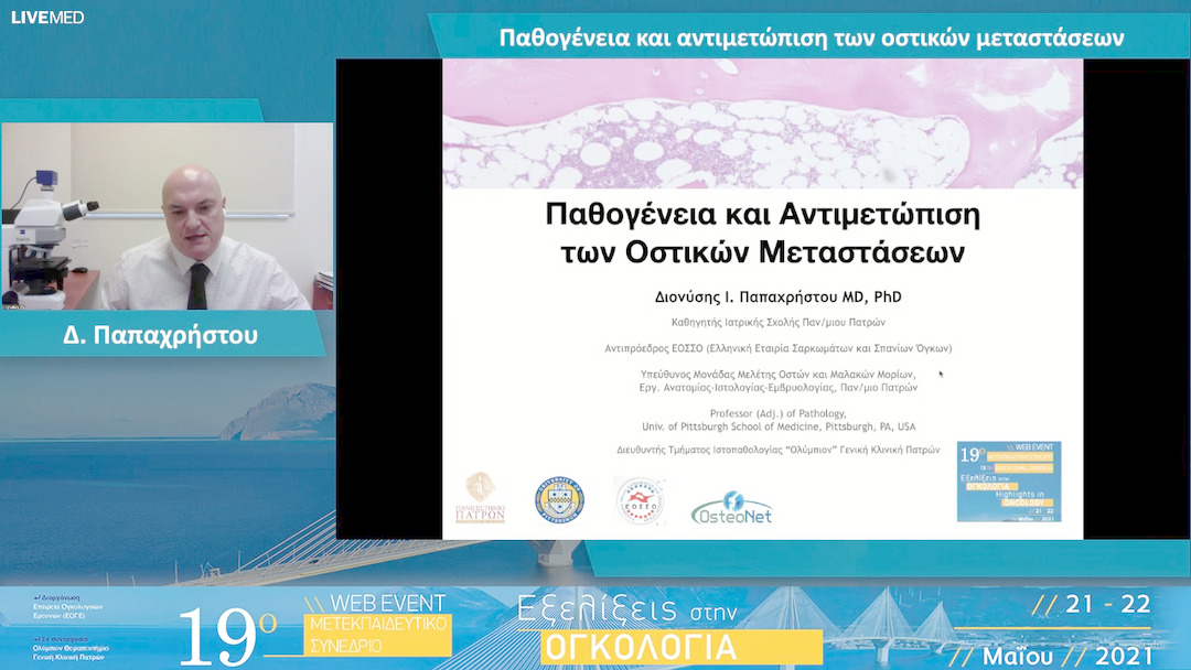 30 Δ. Παπαχρήστου - Παθογένεια και αντιμετώπιση των οστικών μεταστάσεων