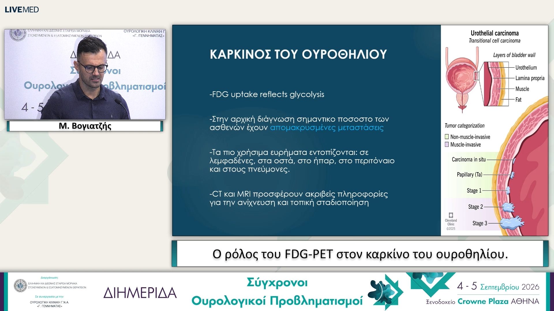 26 Μ. Βογιατζής - Ο ρόλος του FDG-PET στον καρκίνο του ουροθηλίου. 