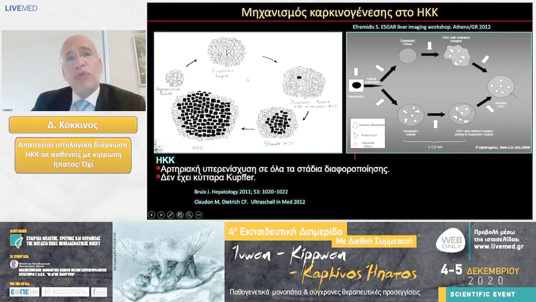 09 Δ. Κόκκινος - Απαιτείται ιστολογική διάγνωση ΗΚΚ σε ασθενείς με κίρρωση ήπατος. Όχι