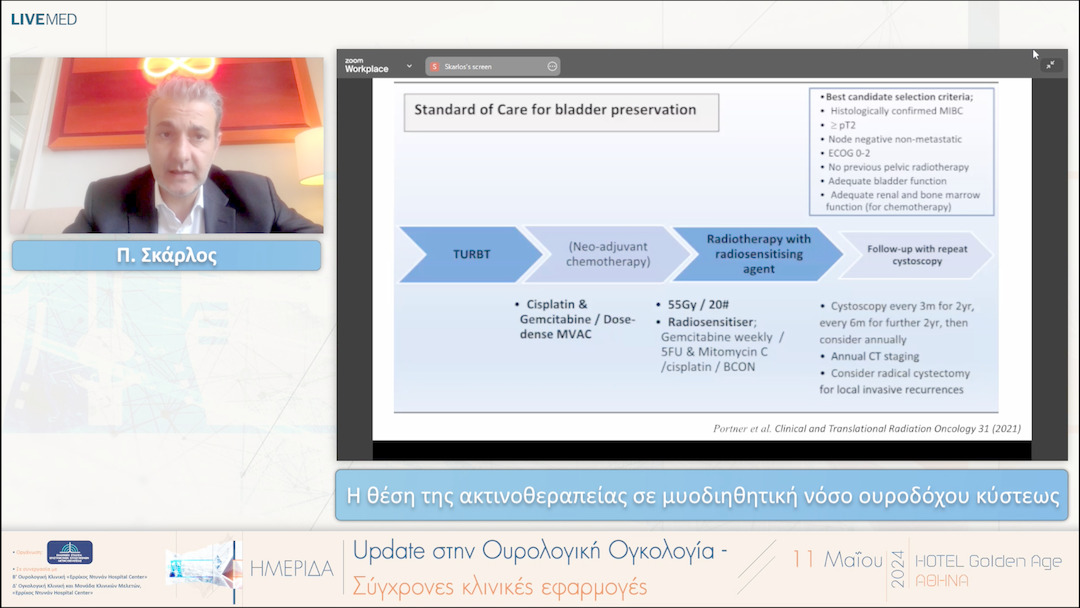 17 Π. Σκάρλος - Η θέση της ακτινοθεραπείας σε μυοδιηθητική νόσο ουροδόχου κύστεως 