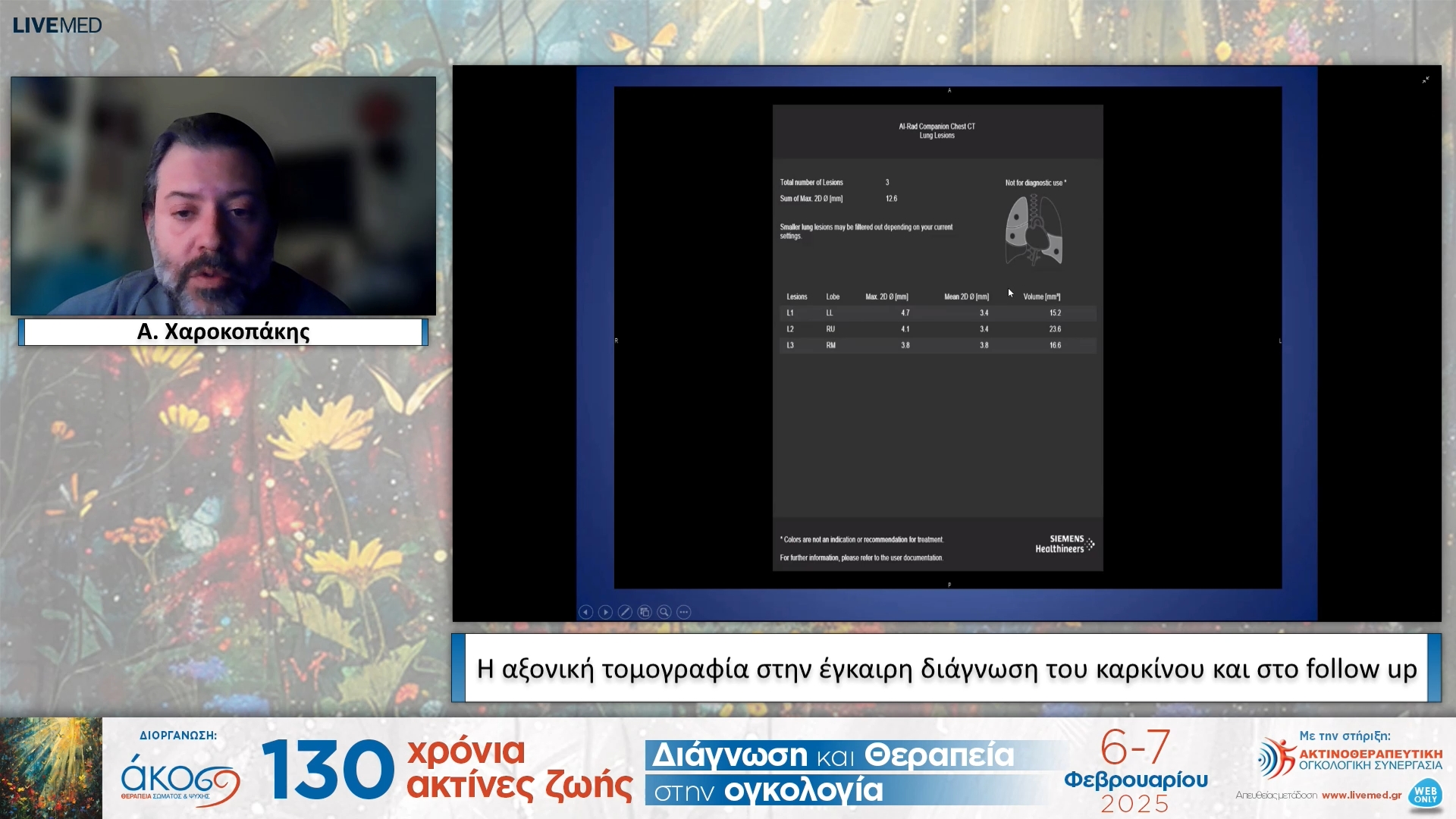06 Α. Χαροκοπάκης - Η αξονική τομογραφία στην έγκαιρη διάγνωση του καρκίνου και στο follow up