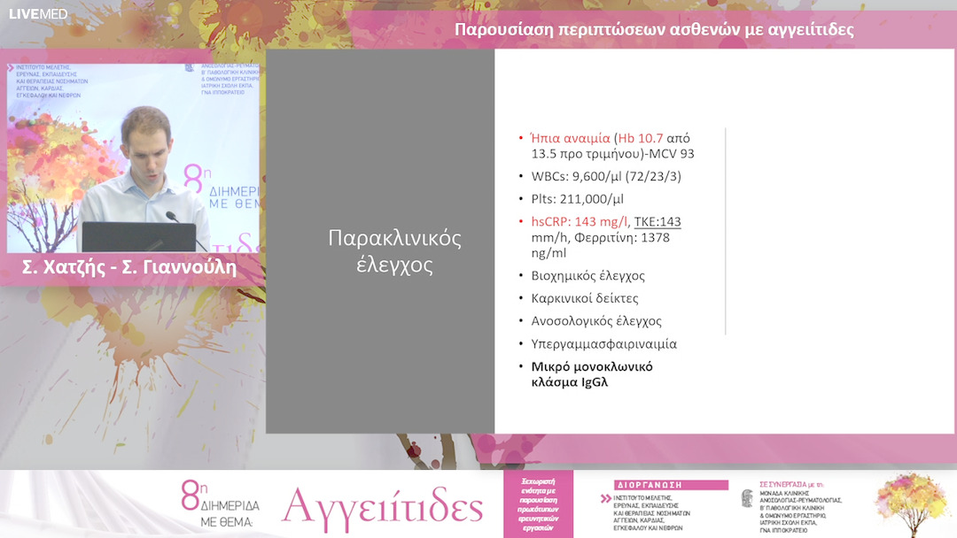 29 Σ. Χατζής - Σ. Γιαννούλη - Παρουσίαση περιπτώσεων ασθενών με αγγειίτιδες