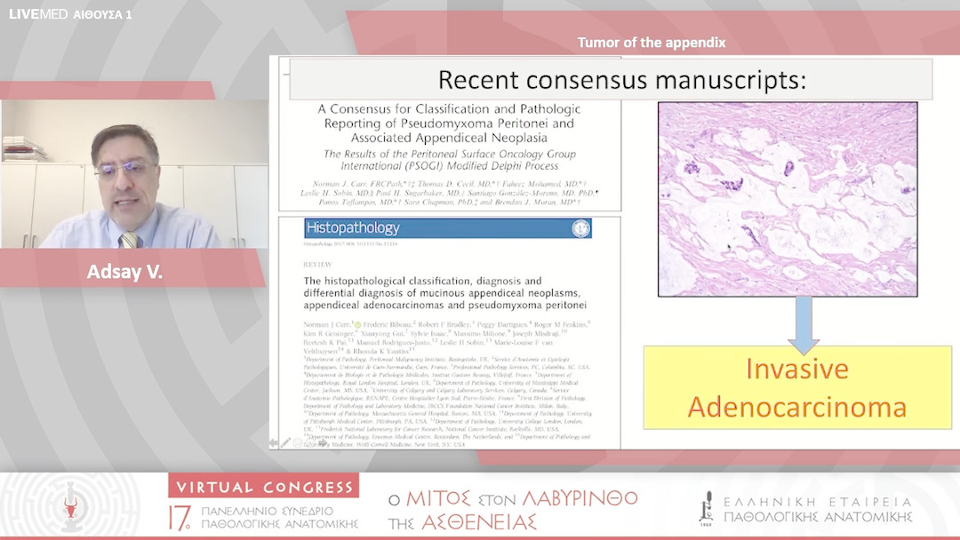 76 Adsay V. - Tumor of the appendix 