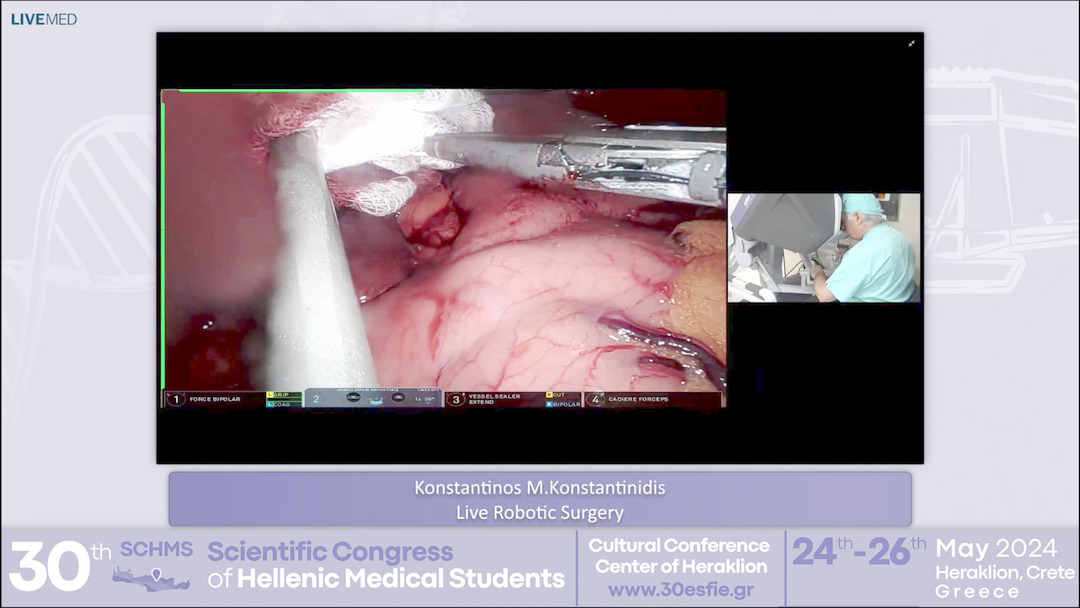 34 Konstantinos M. Konstantinidis - Live Robotic Surgery