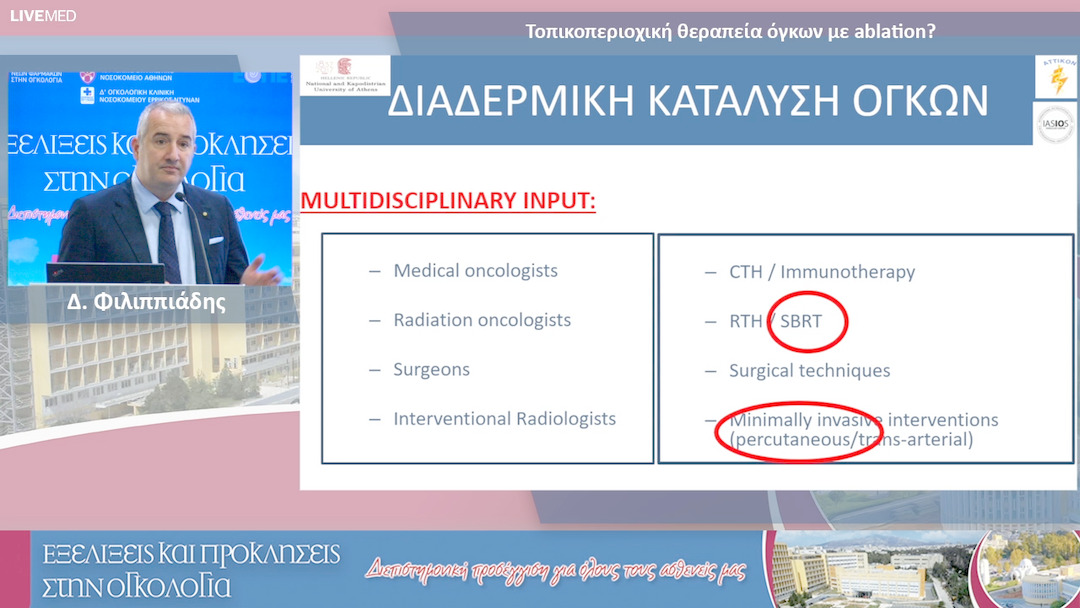 14 Δ. Φιλιππιάδης - Τοπικοπεριοχική θεραπεία όγκων με ablation