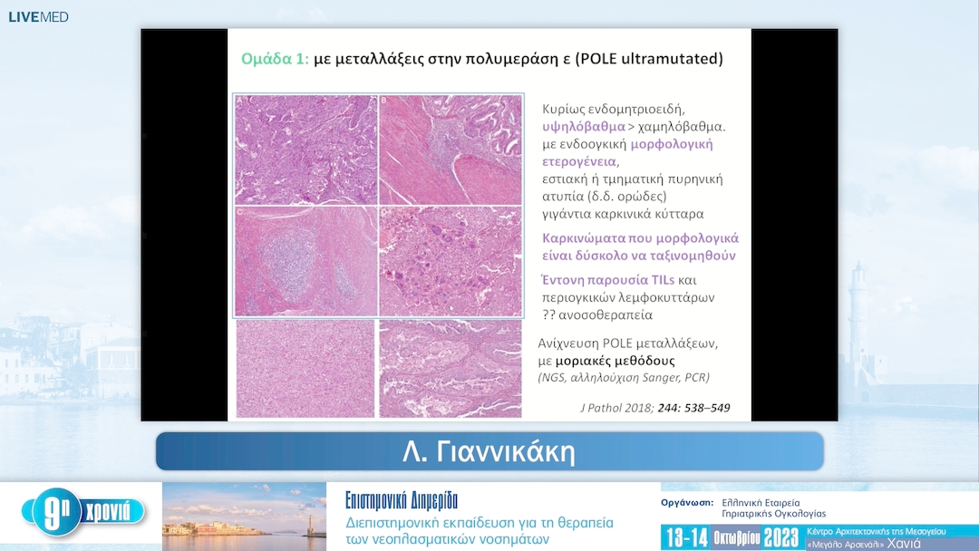 18 Λ. Γιαννικάκη - Καρκίνωμα ενδομητρίου: Ο ρόλος της μορφολογίας στη μοριακή ταξινόμηση 
