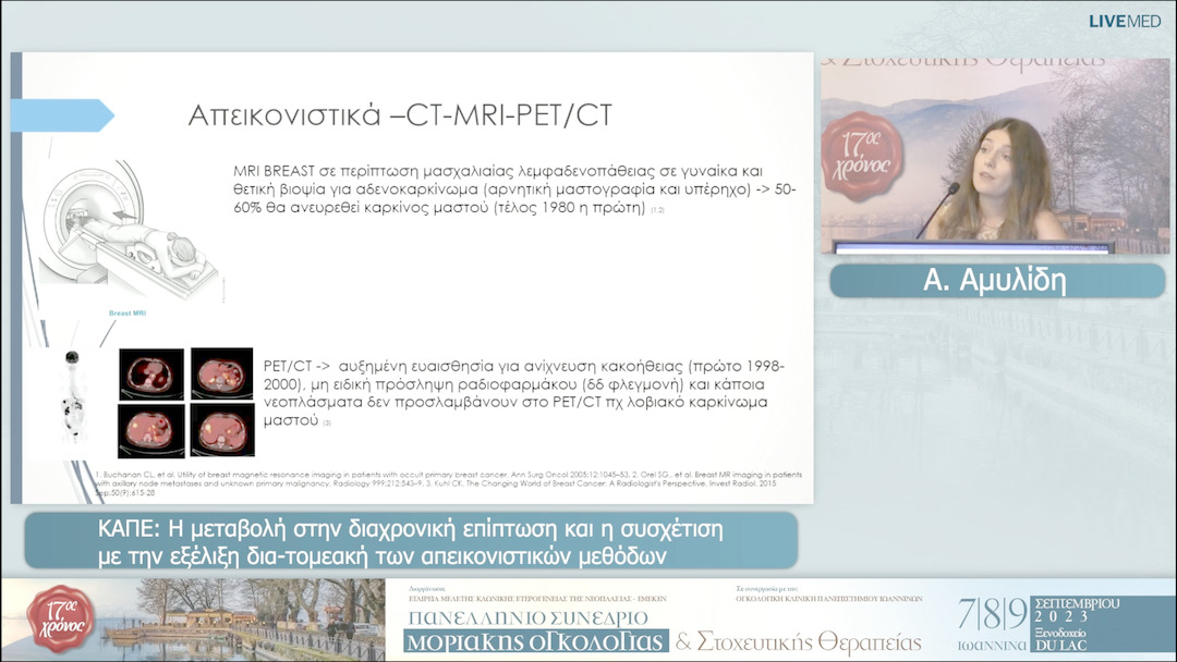 61 Α.-Λ. Αμυλίδη - KAΠΕ: Η μεταβολή στην διαχρονική επίπτωση και η συσχέτιση με την εξέλιξη δια-τομεακή των απεικονιστικών μεθόδων 