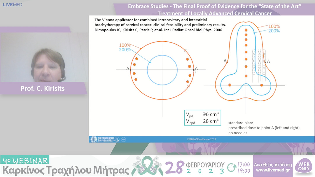 05 Prof. C. Kirisits - Embrace Studies - The Final Proof of Evidence for the “State of the Art” Treatment of Locally Advanced Cervical Cancer 