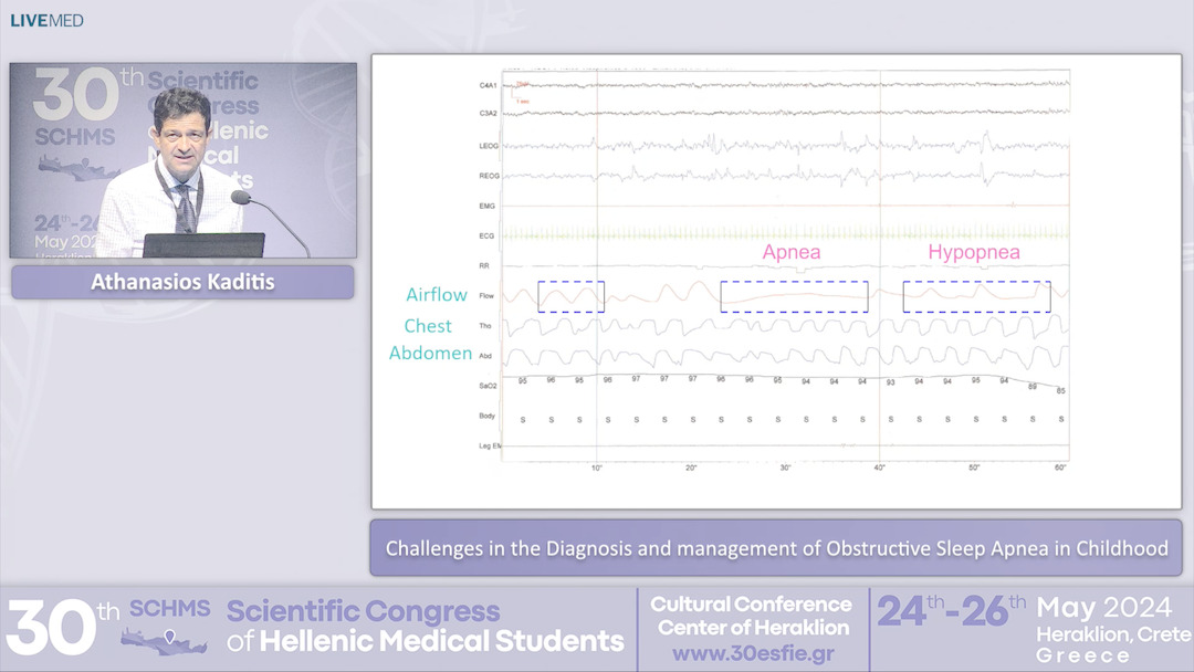 61 Athanasios Kaditis - Challenges in the Diagnosis and management of Obstructive Sleep Apnea in Childhood
