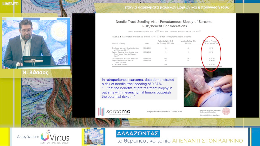 15 Ν. Βάσσος - Σαρκώματα οπισθοπεριτοναϊκού χώρου: Η βέλτιστη χειρουργική προσέγγιση 
