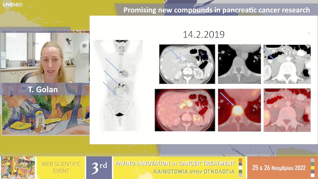 47 T. Golan - Promising new compounds in pancreatic cancer research
