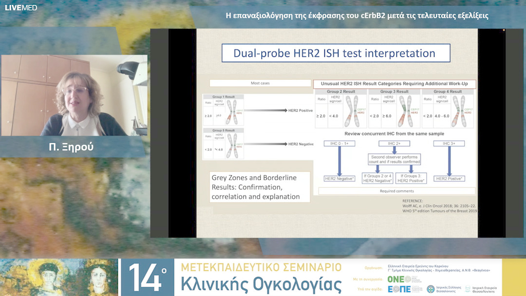 21 Π. Ξηρού - Η επαναξιολόγηση της έκφρασης του cErbB2 μετά τις τελευταίες εξελίξεις.